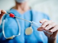 Novoobjavená biela krvinka môže predstavovať medicínsky zázrak: Mala by liečiť rakovinu