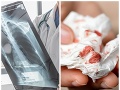Zamestnanec základnej školy v Čadci ohrozil kopu detí, má tuberkulózu! Riaditeľka prijala opatrenia