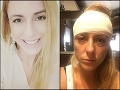 Príbeh týranej Simony: Bývalý muž ma mlátil päsťami, keď siahol na dcéru, povedala som si DOSŤ!