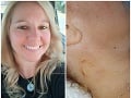 Horor v exotickom raji: FOTO Zranená blondínka sa na klinike dozvedela šokujúcu správu!