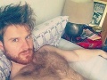 Mladík chcel mať sex, skončil so zdevastovaným penisom: FOTO jeho utrpenia