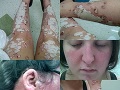 VIDEO Telo matky (23) je znetvorené chrastami: Vážna choroba, TAKTO sa začala
