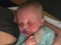FOTO Matka zúri: Jej dcérka sa nakazila osýpkami od nezaočkovaného dieťaťa, šikanujú ale ju!