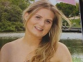 Dievčinu (24) takmer zabil zub múdrosti: Ani netušila, čo sa kvôli nemu odohráva v jej tele