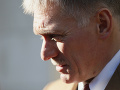 Dmitrij Peskov Dmitrij Peskov