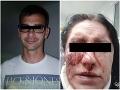 Brutálny útok na Slovenku Mišku v Prahe: Kopanec do hlavy v metre! O agresívnom ex prehovorila jej mama