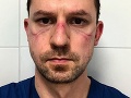 KORONAVÍRUS Slovák žijúci v Taliansku: FOTO Keď zistíte, čo sa skrýva za jeho ranami, neubránite sa slzám