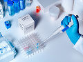 KORONAVÍRUS V Izraeli vyvinuli čuchový test na včasnú detekciu choroby COVID-19