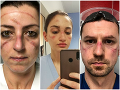 KORONAVÍRUS Toto sú skutoční hrdinovia: FOTO Zničených lekárov, ktorí drú v nemocniciach do noci