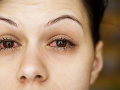 KORONAVÍRUS Nové výskumy priniesli nové zistenia: Nákaza môže spôsobiť aj problémy s očami