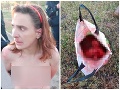 Brutálny čin za hranicami: FOTO Rozrušená nahá žena behala po ulici, v taške skrývala hlavu dcéry