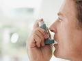 Každý desiaty Slovák má alergiu: Spolu s astmou nás ročne stoja takmer 790 miliónov eur