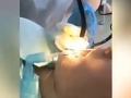 VIDEO Dievčine bolo nevoľno, zašla k lekárke: Tá sa skoro pozvracala z toho, čo s z nej vytiahla
