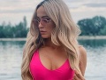 Po silikónoch ďalšia plastika? Po silikónoch ďalšia plastika?