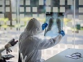 KORONAVÍRUS Novým kalifornským variantom sa znovu nakazila osoba vyliečená z covidu