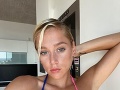 Speváčka Emma Drobná skončila na pohotovosti: Bože, to vyzerá strašne!