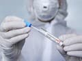 KORONAVÍRUS Česká vláda chce motivovať na očkovanie: Od septembra nebude preplácať testy