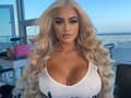 FOTO Blondínka (21) si nechala napichať zadok: Lekári sú zdesení, nie je jej čo závidieť