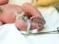 Lekári upozorňujú na pravidlo 60 sekúnd pri pôrode: Dokáže zachrániť životy detí