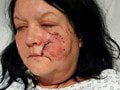 Ženu (43) napadol kamarátkin pes: Brutálny útok trval 45 minút! Husky ju znetvoril, FOTO zranení