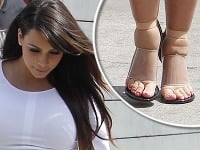Kim Kardashian svoje opuchnuté chodidlá trápi v príliš tesnej obuvi.