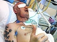 Tvár Poliakovi dokaličila rezačka kameňa koncom apríla 2013 Tvár Poliakovi dokaličila rezačka kameňa koncom apríla 2013