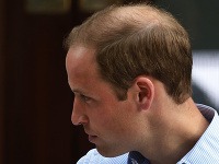 Princovi Williamovi vlasy ubúdajú rýchlym tempom.