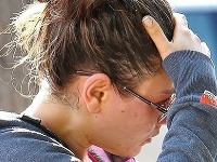 Mila Kunis bez mejkapu ukázala mastné vlasy aj veľké zapálené vyrážky.