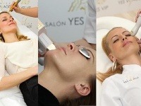 Kam sú až schopné zájsť celebrity pre mladšiu tvár a štíhlejšiu postavu?