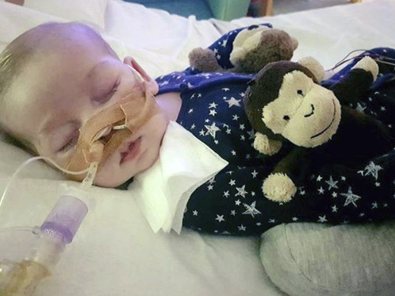 Na nedatovanej snímke je smrteľne chorý, 11-mesačný Charlie Gard v londýnskej nemocnici Great Ormond Hospital. 