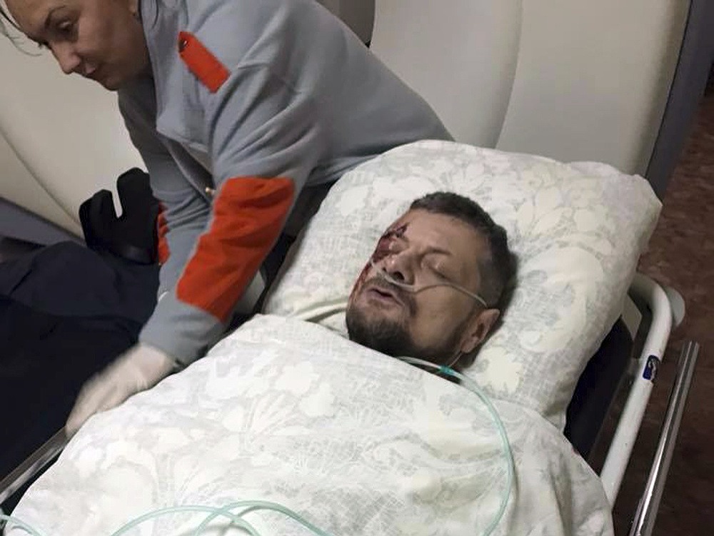 Zranený ukrajinský poslanec Ihor Mosijčuk