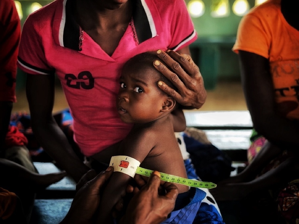 Identifikácia podvýživy pomocou MUAC pásky, ktorá slúži na určenie stavu podvýživy aj v odľahlých komunitách v Kongu.