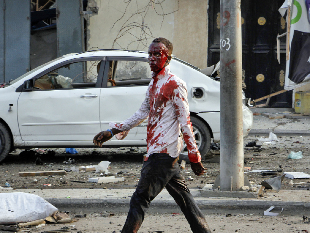 Zranený muž kráča ulicou po bombovom útoku v somálskej metropole Mogadišo.