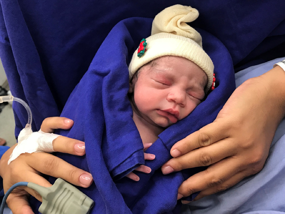V Brazílii sa narodilo prvé dieťa z transplantovanej maternice mŕtvej ženy
