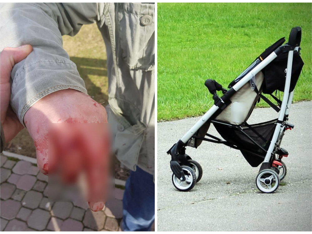 Útok psov: Muž kočíkoval vnúča, to sa snažil ochrániť.