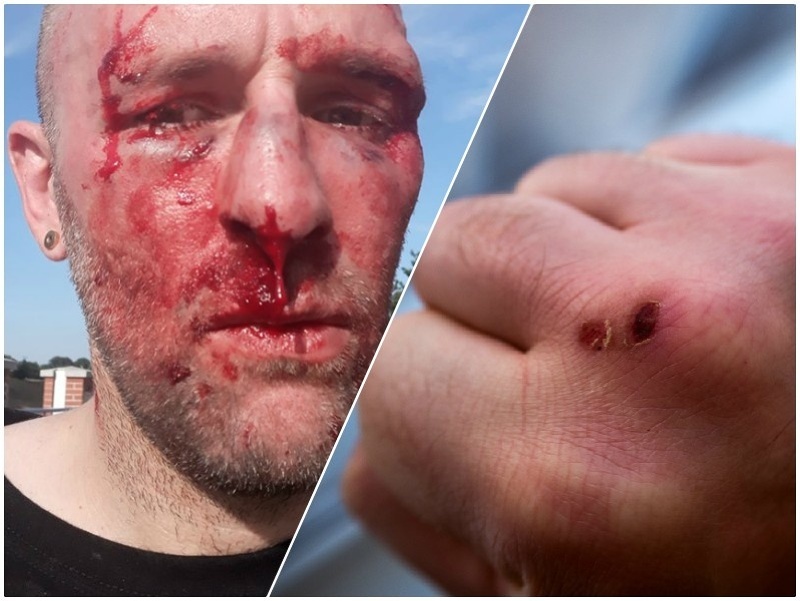 Poľský novinár skončil s krvavými ranami na tvári