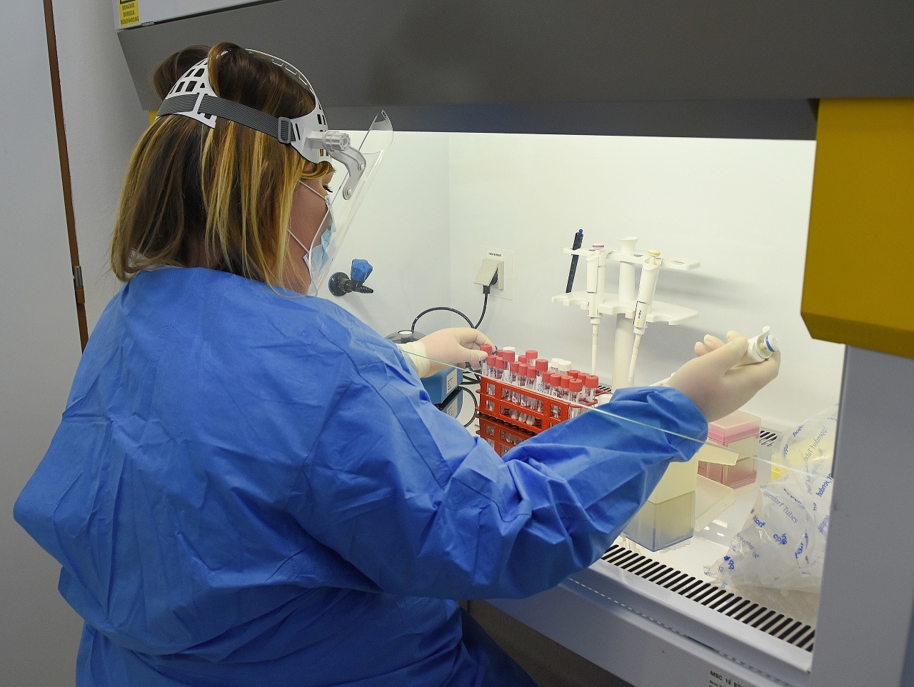 Pracovníčka v Ružomberku testuje vzorky na prítomnosť ochorenia