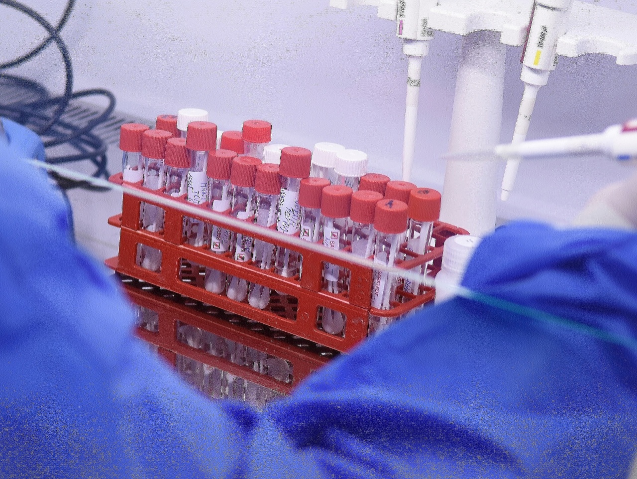 Pracovníčka v Ružomberku testuje vzorky na prítomnosť ochorenia