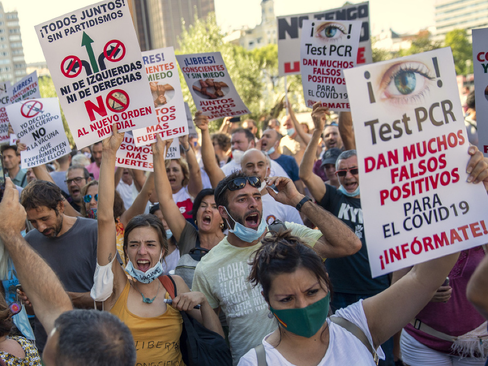 Stovky ľudí protestovali proti povinnému noseniu rúšok a ďalším opatreniam, ktoré španielska vláda zaviedla v súvislosti s pandémiou koronavírusu SARS-CoV-2 v Madride