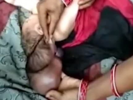 V Indii sa narodilo dieťa s tromi hlavami.