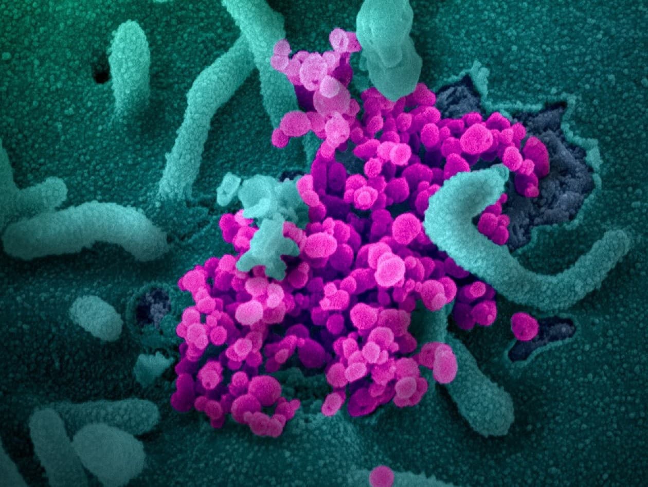 Koronavírus (ružový) pod elektrónovým mikroskopom.