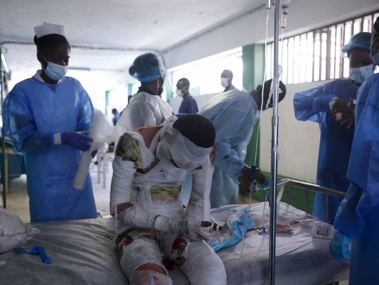 Zranených po výbuchu ošetrujú v nemocnici