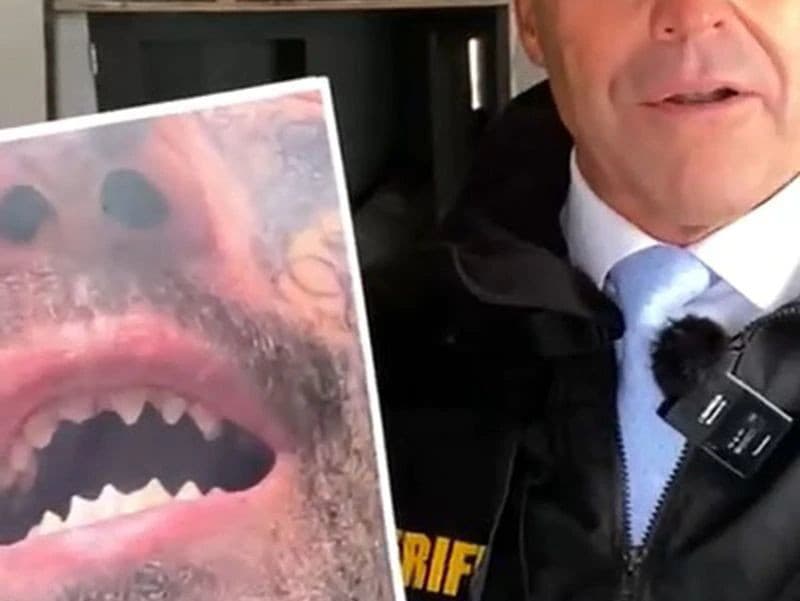 Šerif ukazuje fotku zubov Michaela Barajasa.