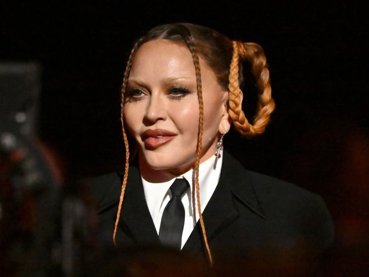 Madonna na Grammy Awards šokovala spuchnutou tvárou.