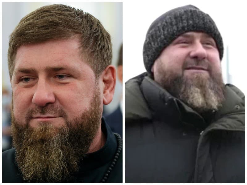 Čečenský vodca Ramzan Kadyrov priberá nekontrolovateľnou rýchlosťou. Čo sa s ním deje?