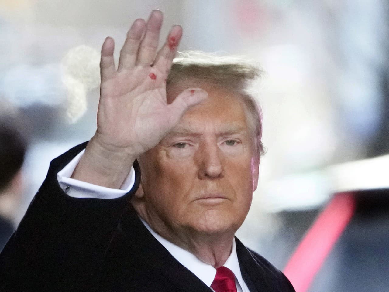 Donald Trump mal na pravej ruky misteriózne škvrny.