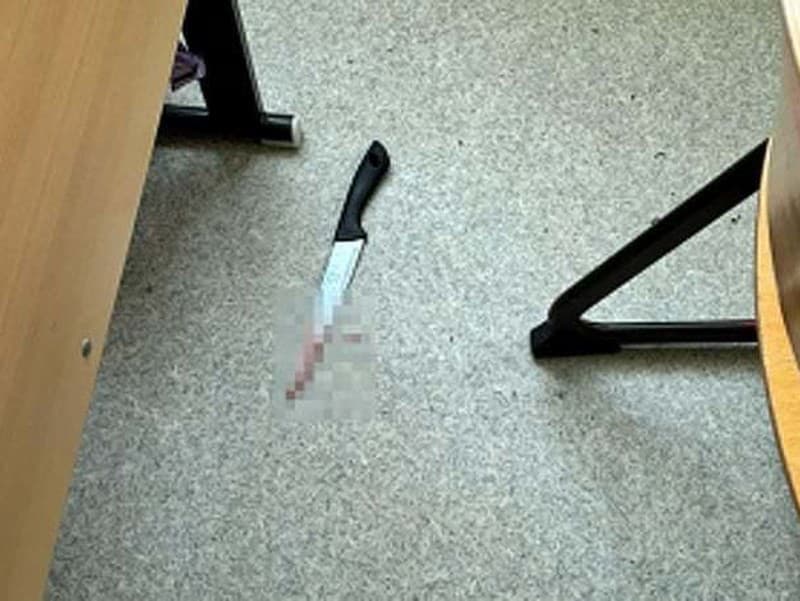 Týmto nožom mala útočiť školáčka.