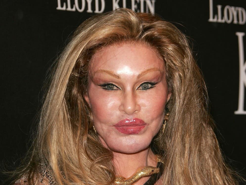 Jocelyn Wildenstein.