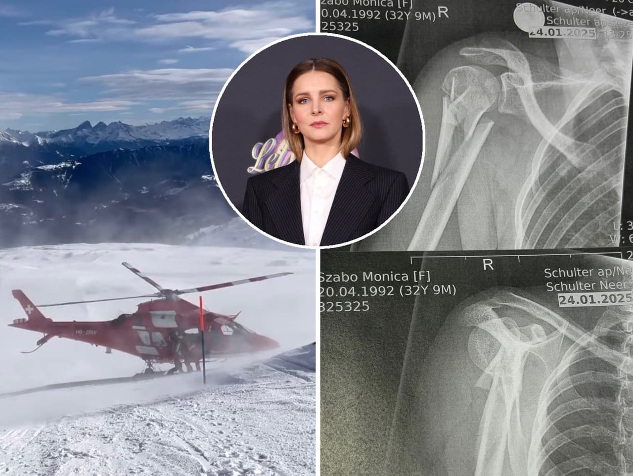 Monika Szabó sa vážne zranila