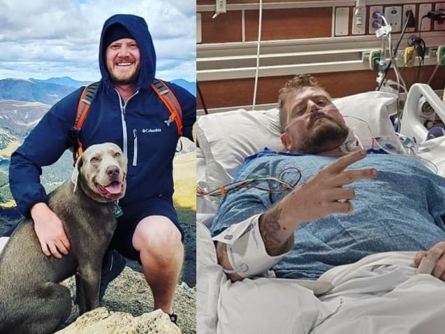 Max Armstrong (40) si na výlete popálil prst o horúcu panvicu. O niekoľko dní už bojoval o život. Zachránila ho až amputácia obidvoch nôh. 